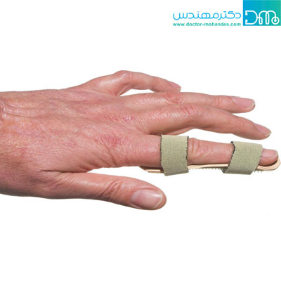 استفاده از آتل برای درمان انگشت ماشه ای