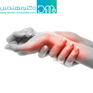  تسهیل درمان درد های مچ دست