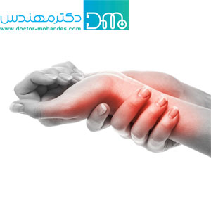 تسهیل درمان درد های مچ دست