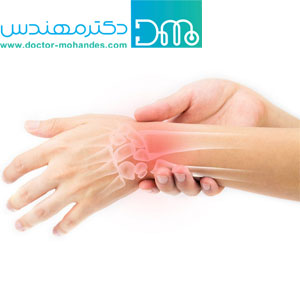 مچ بند آتل دار نئوپرن با آتل شست سماطب مچ بند آتل دار نئوپرن با آتل شست سماطب