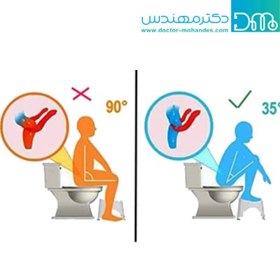 درمان یبوست شدید