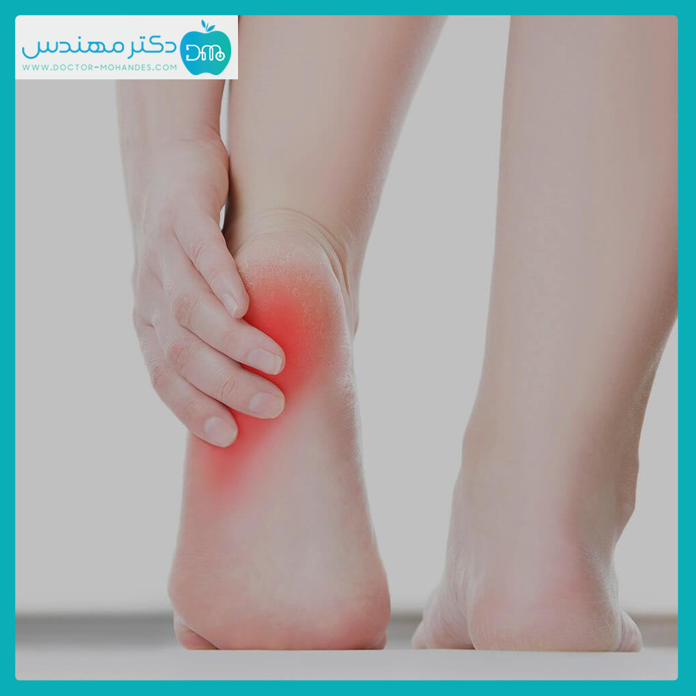 عوامل ایجاد خار پاشنه 2 khar_oashne2.jpg