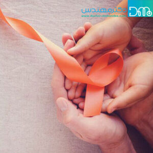 علائم ام اس