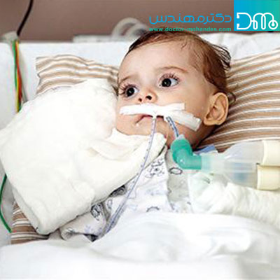علائم بیماری اس ام ای علائم بیماری اس ام ای