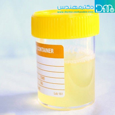 رنگ طبیعی ادرار
