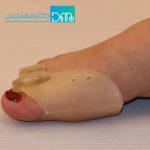 هالوکس پیشرفته