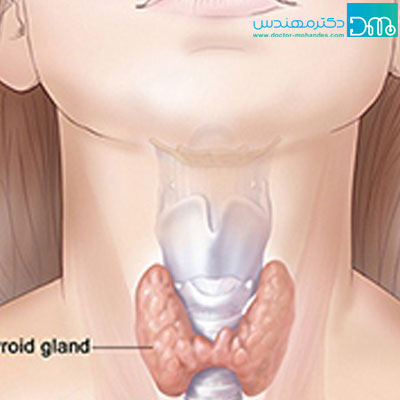 کم کاری تیروئید kamkari tiroid