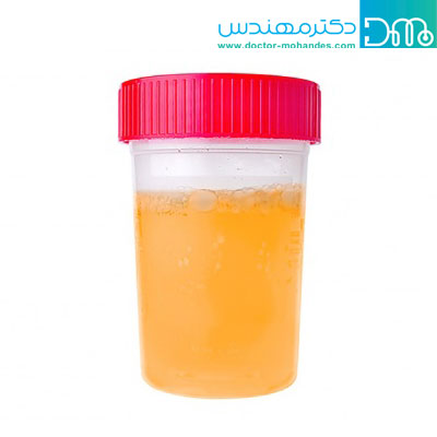 رنگ غیر طبیعی ادرار