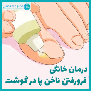 درمان خانگی فرو رفتن ناخن پا در گوشت
