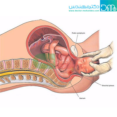 آیا اضافه وزن در بارداری خطرناک است آیا اضافه وزن در بارداری خطرناک است