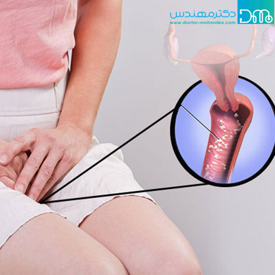 علائم عفونت واژن alaem ofonat vazhen