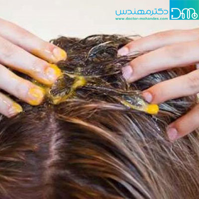 درمان خانگی خارش سر درمان خانگی خارش سر