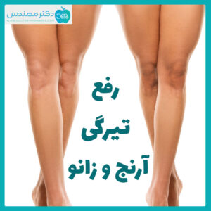 از بین بردن تیرگی آرنج و زانو