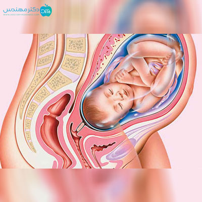 چگونه بفهمیم کیسه آب پاره شده 2 ab1.jpg