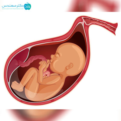 چگونه بفهمیم کیسه آب پاره شده 5 ab6.jpg
