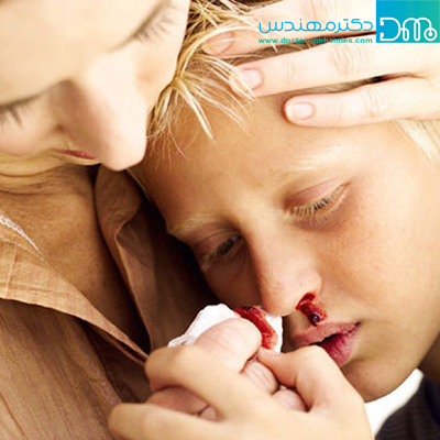 علائم هموفیلی علائم هموفیلی