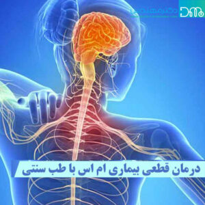 درمان ام اس در طب سنتی