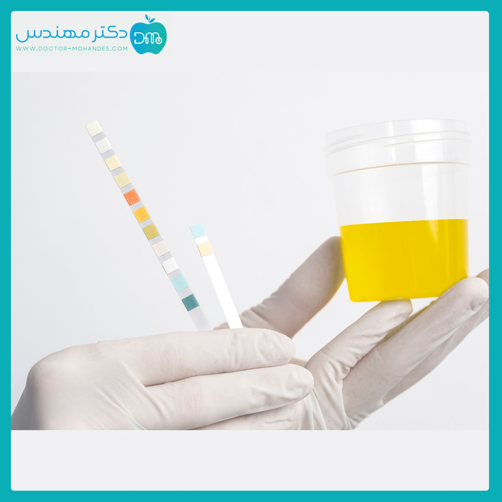 وجود خون در ادرار نشانه چیست؟ 4 erdar-tashkhis099.jpg