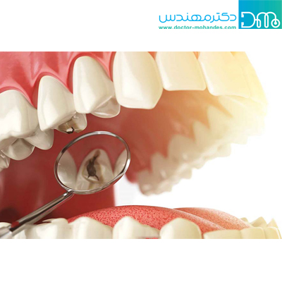 عوارض رژیم گیاهخواری عوارض رژیم گیاهخواری
