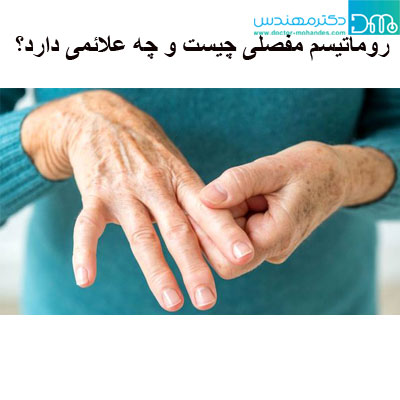 درمان گیاهی روماتیسم مفصلی