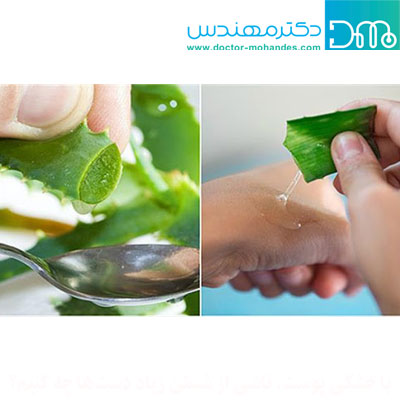 آلوئه ورا aloevera