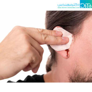 علائم پارگی پرده گوش؛ علت و روش‌های درمان آن