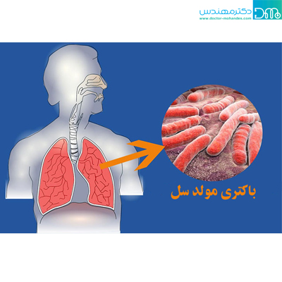 علت بیماری سل علت بیماری سل