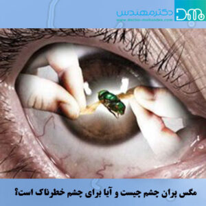 مگس پران چشم