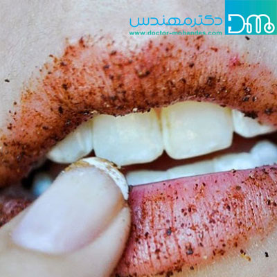 برجسته کردن لب با دارچین bozorgkardanelab2