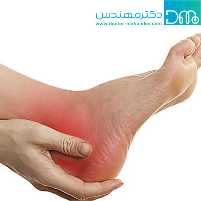علت برآمدگی پا چیست؟ elatekharepashne