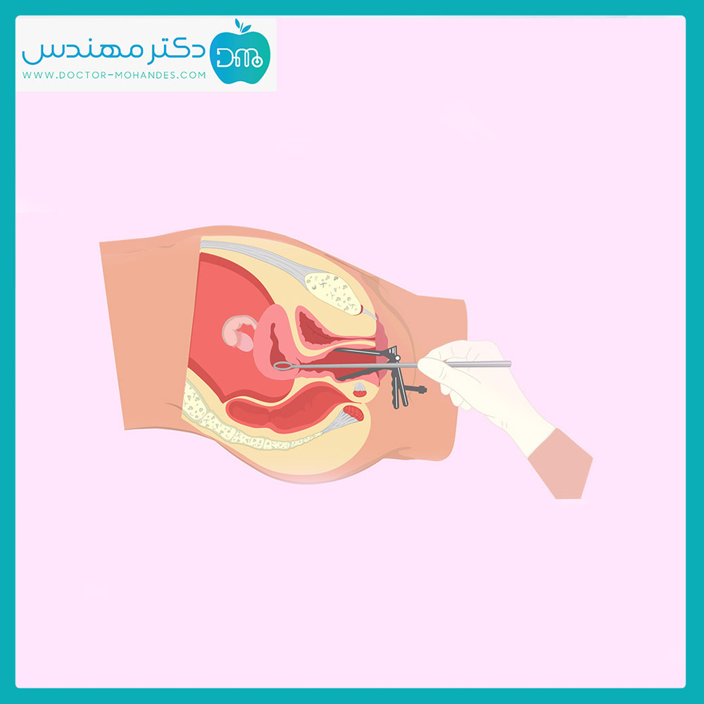 از کجا بفهمم جنین کامل سقط شده؟ 4 seght-_janin.jpg