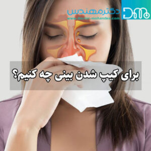 کیپ شدن بینی