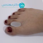 لا انگشتی foot care - Image 5