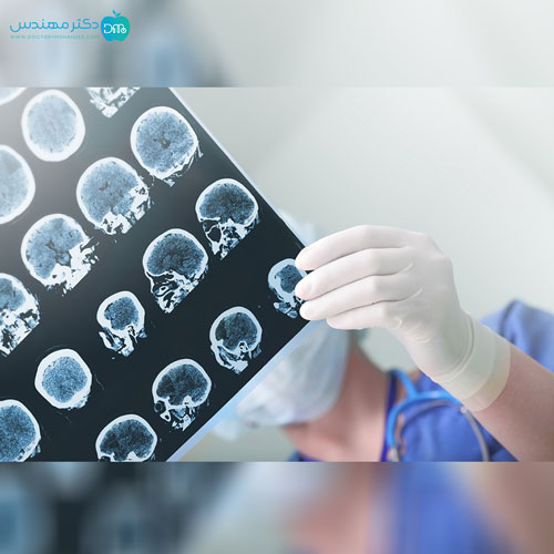 بیماری ام اس (MS)؛ علائم، عوارض، روش تشخیص و درمان قطعی 7 ms5.jpg