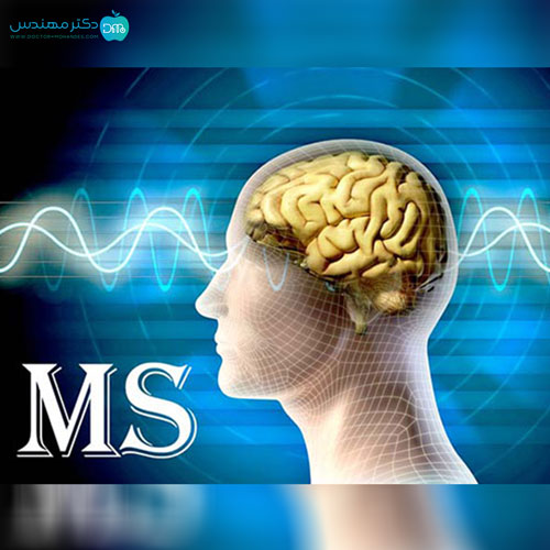 بیماری ام اس (MS)؛ علائم، عوارض، روش تشخیص و درمان قطعی 2 ms8.jpg