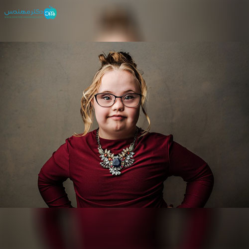 سندروم داون 3 san10.jpg