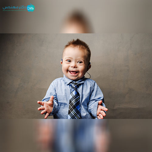 سندروم داون 2 san12.jpg