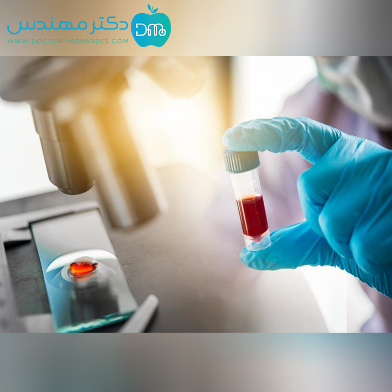 آزمایش CA125 یا آنتی ژن سرطانی چیست؟ 3 hCLHDA