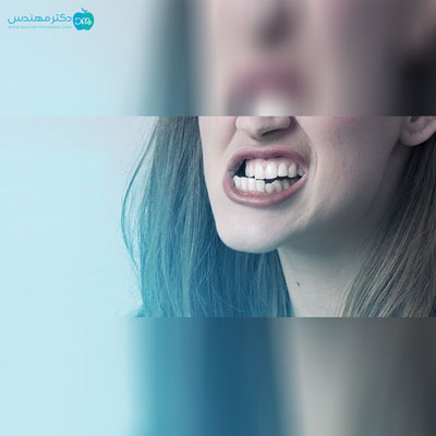 دندان قروچه در بزرگسالان 2 qoroche2.jpg