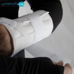مچ بند پل دار پاک سمن دست راست 011 - Image 4