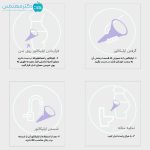اپلیکاتور ادرار دائمی بانوان دخت - Image 9
