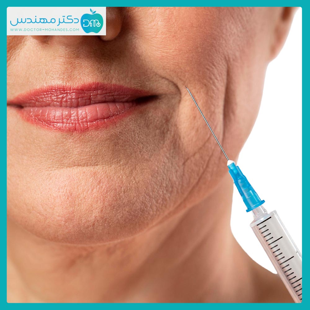 تزریق ژل: مزایا، عوارض، مواد تشکیلدهنده و تقلبهای رایج در ایران 3 تزریق ژل عوارض