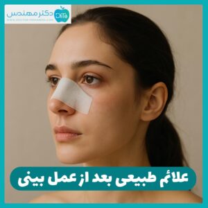 علائم طبیعی بعد از عمل بینی