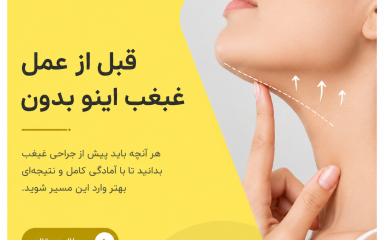 قبل از عمل غبغب این‌ها رو حتماً بدون! | راهنمای کامل آمادگی، روش‌ها و هزینه‌ها