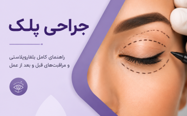 همه چیز درباره جراحی پلک (بلفاروپلاستی) | آیا کاندید مناسبی هستی؟ چه انتظاری از عمل پلک داشته باشی؟