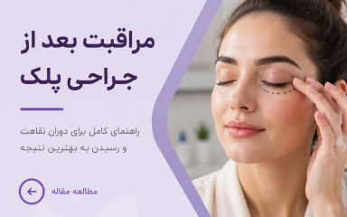 مراقبت بعد از جراحی پلک | از کبودی و تاری دید تا علائم خطر و زمان برگشت به زندگی عادی