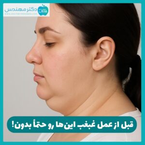 عمل غبغب