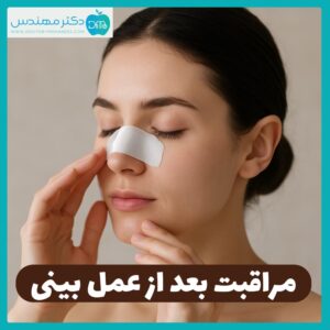مراقبت بعد از عمل بینی